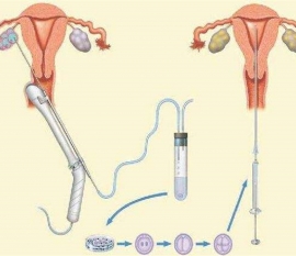 35岁女性备孕请做好以下检查，“健康佛山代生宝宝”跑不远